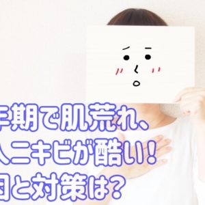 更年期で肌荒れ・大人ニキビ（吹き出物）が酷い！原因と対策は？